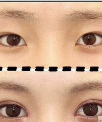 ȥ˫Ƥҽҿİ᲻᲻˫