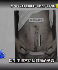 我,一个18岁女学生,为了3万穿刺取卵,差点没了命