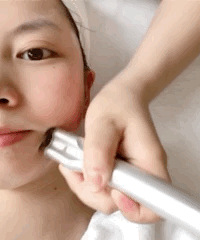 热玛吉、超声刀太贵还痛,试试这个,做完鼻翼两侧法令纹明显提升