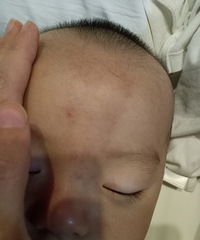 ͷмһźɫ̥ǣ֪ǲѪ