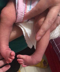 ��ë֢���ֽŻ��Σ���Щ������춼�鲻������