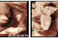 ��ά�ʳ�ȫ���̣����ڿ���̥����������