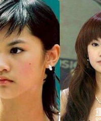 这个女明星到底做了哪些医美?为什么越老越好看?!