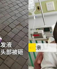 气愤!天降洗发液婴儿头部被砸变形