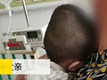 婴儿遭高空抛物砸伤