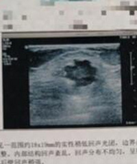 ����ͻȻ�����ٰ������������֢���������ǲ��Ǻ��ѣ�