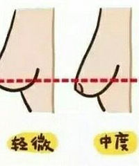 我知道母乳喂养好,可是怎么没人说喂奶后胸会变得这么惨....