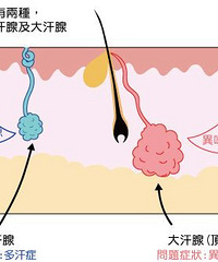 治疗腋臭有什么方法?贵阳做腋臭手术哪家医院正规?