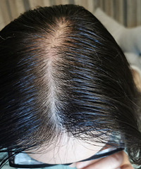 ͺͷ������Ծȣ�������������£�����Ч��̫������