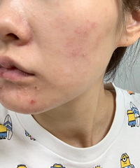 过敏烂脸也挡不住看直播买买买,娇韵诗开箱