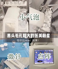 οȥͷëףС+΢/󼤹϶ѡ