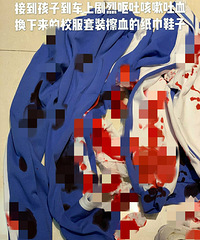 女童被老师体罚致吐血事件反转了?广州警方通报:家长承认撒谎