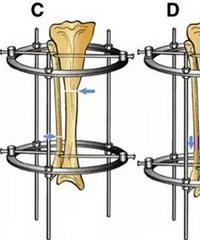 �һ��˼���160000Ԫ���Ϲ����߳���7.2����
