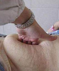 剖腹产不疼?10厘米的麻醉针仅仅是开始,之后疼到你怀疑人生