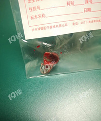 孩子吞食异物271个小时,手术7小时取出!这东西几乎家家都有