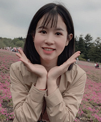 记录双眼皮手术8个月,我也拥有了明星同款娃娃眼,可爱又有灵气