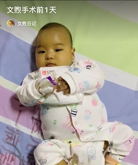 儿子胆道闭锁变成“小黄人”,老婆选择割肝救了他