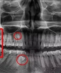 �����³��˿�����Ϊ�˸��������ȫ������������