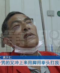 观音桥两女一男酒后肇事,六旬环卫工肋骨、门牙、鼻梁全被打断