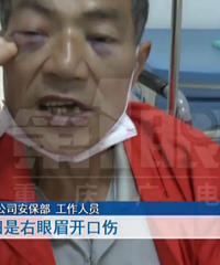 观音桥两女一男酒后肇事,六旬环卫工肋骨、门牙、鼻梁全被打断