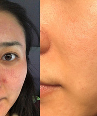 ΢��ʹ�����ʹ���������ֵ��������������ë�׾��б�С