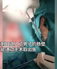 男子腹痛难忍称不小心坐到鱼上