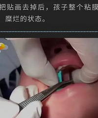 һ��Ůͯ�Է����֣�ȥҽԺ��飬�������ճ����ֽ