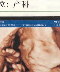 做四维彩超的时候医生说宝宝是个“省钱”的,到底是女还是儿?