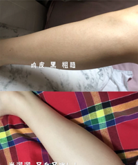 夏天除了防晒,美白我也要