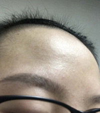 �ѷ��ѵ�ͷƤ���⣬�����ҽԺ��ϴͷ���ƣ�ͷ�����ڳ�������