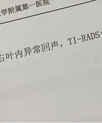 90后朋友被查出甲状腺癌,看了下我的体检报告有点害怕