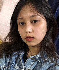 这个眼袋割得太自然,一个月完全恢复,身边的闺蜜都没看出来