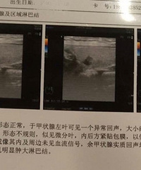 �����Ϊ��״�ٽ��4B����ҽ���û�죬������