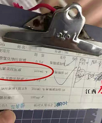 סԺ��̥������2�����ҩ����һ�α����֣��ڶ����Ѿ�����һС��