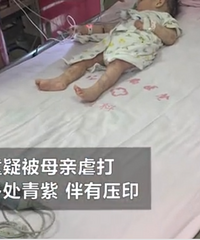 �ɶ���ͯ�ɱ�ĸ��Ű�򣬸��Ų���Ѫ��ȫ�����ڣ���������