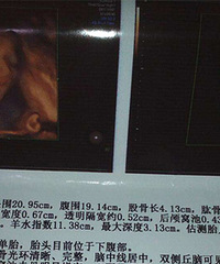 ����˵�����Ĳʳ���Ƭ�����ˣ��ѵ�ֻ���Ҿ��úܿɰ���