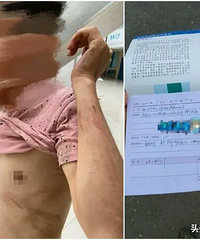 剧组殴打“粉丝”?《皓衣行》发声:对方先动手,打人者已开除