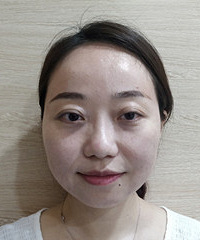尝试了一个瘦脸的新方法,脸上的泡泡肉少了,更显年轻了
