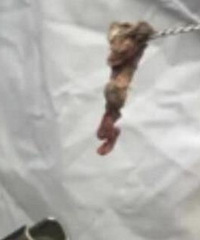 女童散发恶臭隔着家门都能闻到, 母亲带去医院一查当场作呕