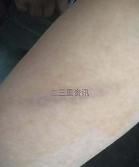 陕西一小学男生遭4名男同学霸凌,家长发现其宿舍被褥有大片血迹