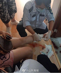 女子上厕所马桶爆裂,鲜血直流