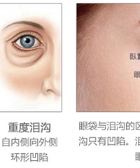 ���������ЩƤ�����⣬����ÿ��������ľ�����û����