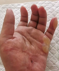陶勇是天使吧!对于砍伤他的那个患者,陶勇不恨并且表示理解