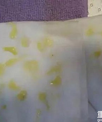 断奶后不排残奶,会引起乳腺疾病、乳腺癌?真相让人吓一跳!