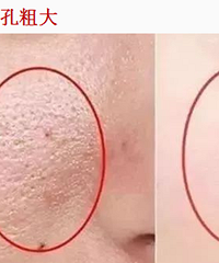 如果你有这些皮肤问题,哪怕每天用上万的精华都没有用