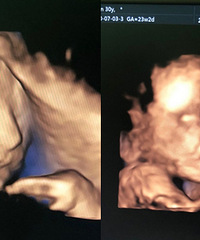 ���Լ��޶�����ά��Ƭ�ŵ���ج�Σ��ҿ����ǵ�һ�˰ɣ�