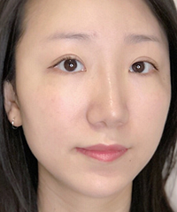 少眉星人真痛苦,纹眉之后整个人精神不少,就算冲动消费也值得了