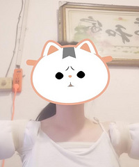 作为95后女孩,我在考研期间做了狐臭手术,说说这段经历