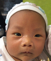 ڶͯҽԺѪƣ۶˫üм䷢Ӷ