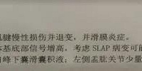提裤子都痛的时候,我才明白“生命在于运动”是真理